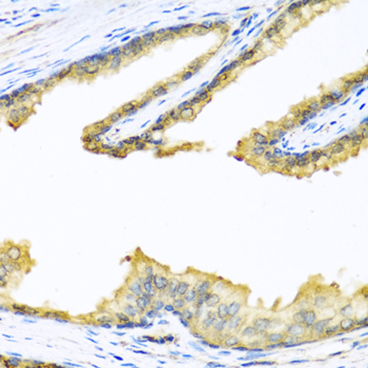 Immunohistochemistry of paraffin-embedded Human prostate using PENK Polyclonal Antibody at dilution of  1:100 (40x lens).