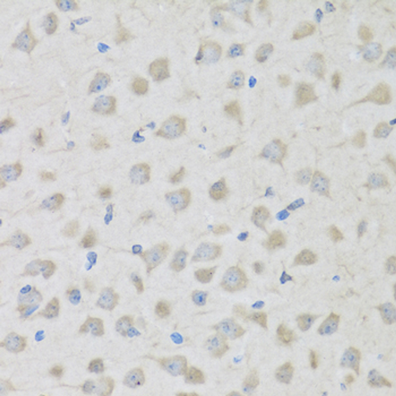 Immunohistochemistry of paraffin-embedded Mouse brain using PENK Polyclonal Antibody at dilution of  1:100 (40x lens).