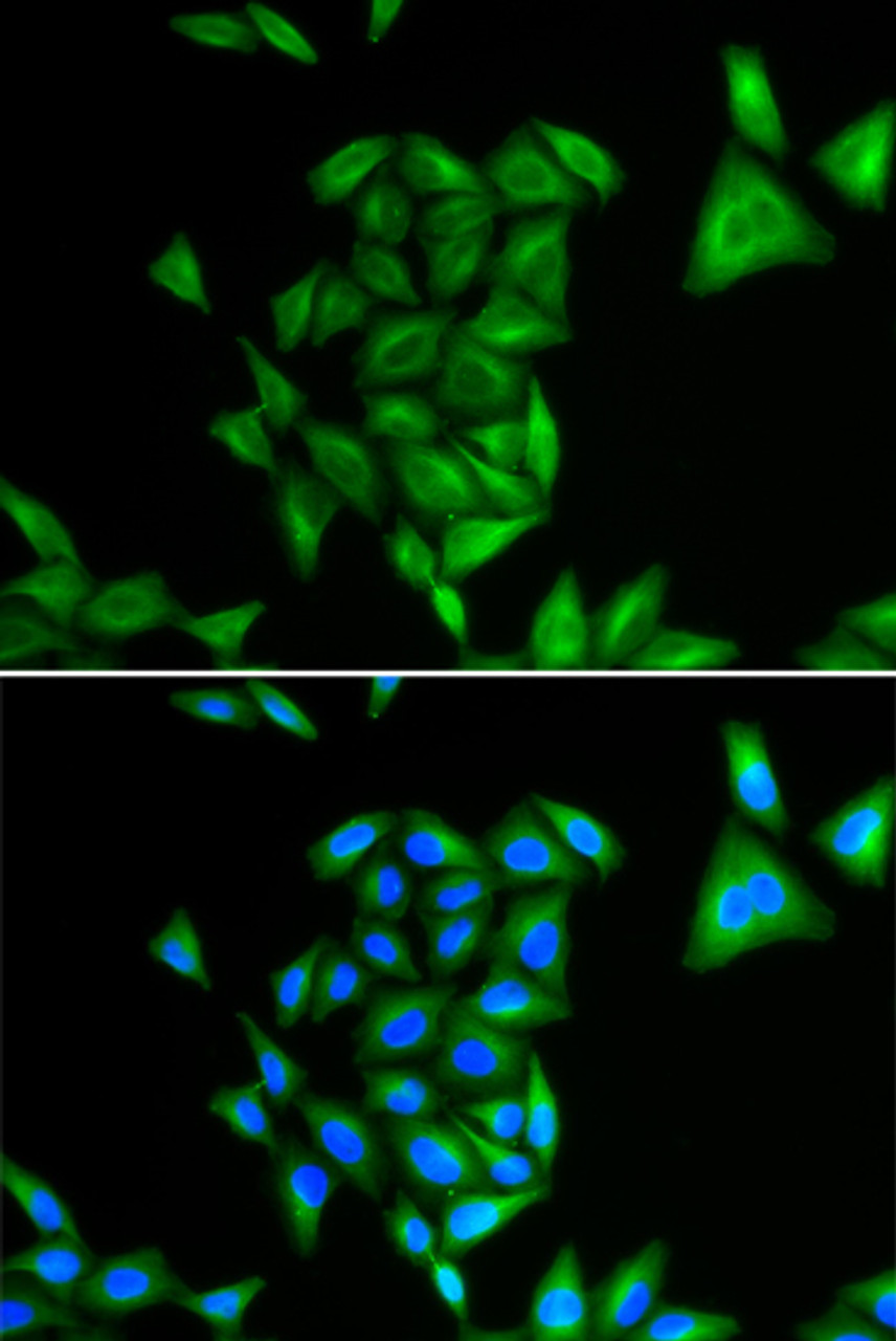 Immunofluorescence analysis of U2OS cells using PHYH Polyclonal Antibody