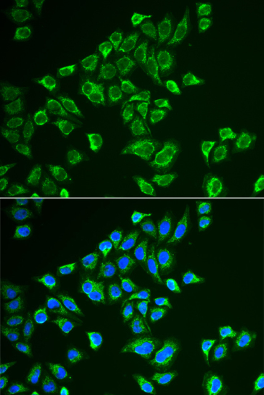 Immunofluorescence analysis of HeLa cells using TAC3 Polyclonal Antibody