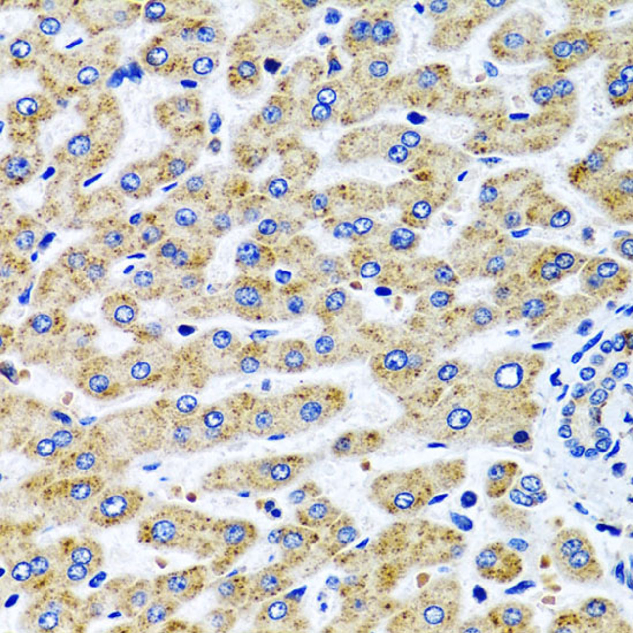Immunohistochemistry of paraffin-embedded Human liver using SERPINA7 Polyclonal Antibody at dilution of  1:100 (40x lens).