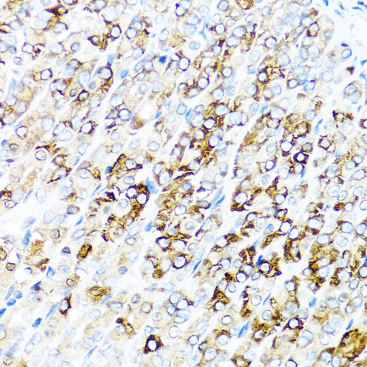 Immunohistochemistry of paraffin-embedded Mouse stomach using SERPINA7 Polyclonal Antibody at dilution of  1:100 (40x lens).