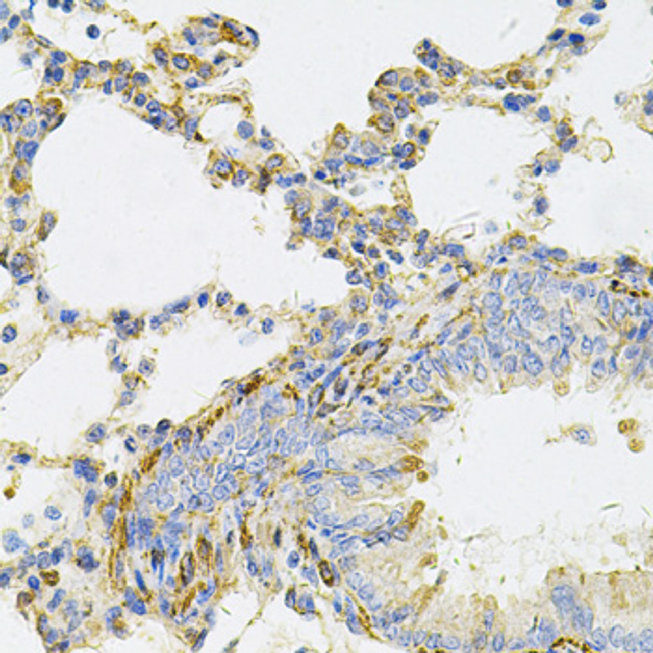 Immunohistochemistry of paraffin-embedded Rat lung using UBE2B Polyclonal Antibody at dilution of  1:100 (40x lens).