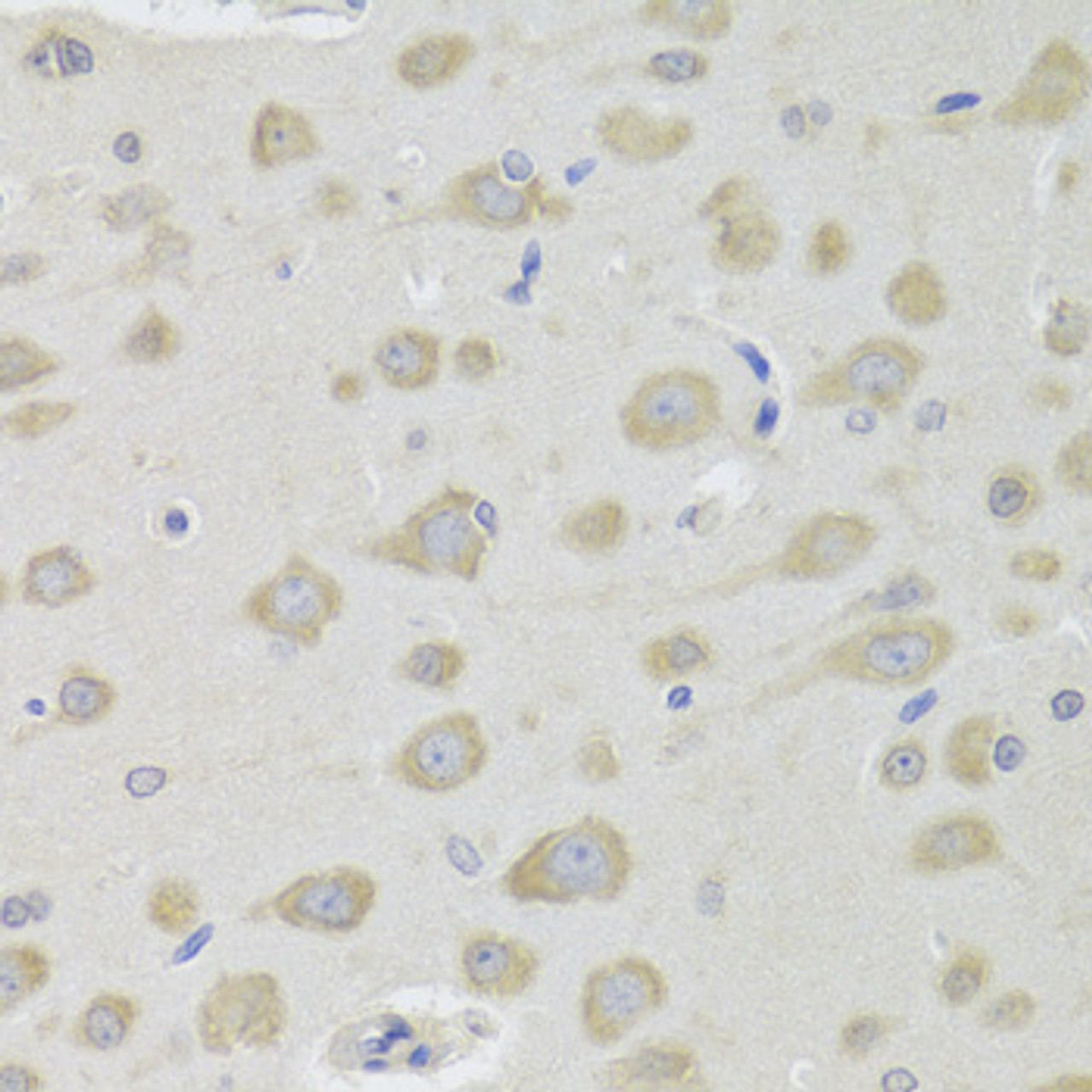 Immunohistochemistry of paraffin-embedded Rat brain using DHRS9 Polyclonal Antibody at dilution of  1:100 (40x lens).