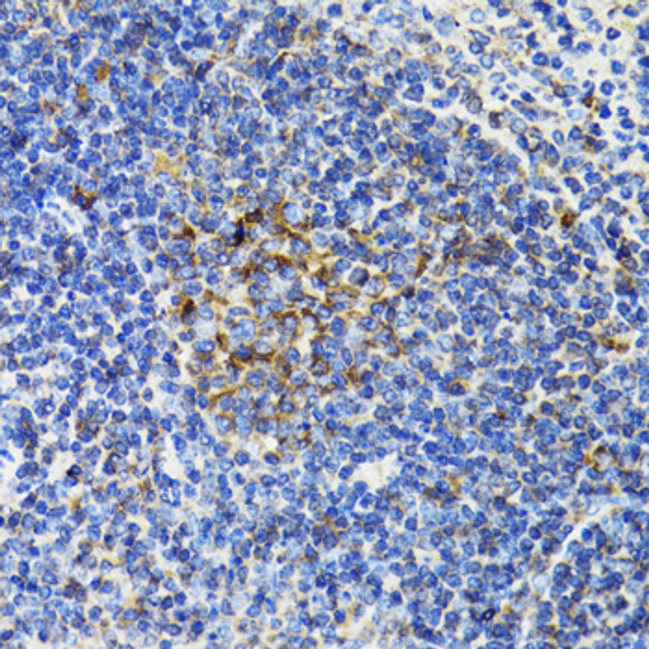 Immunohistochemistry of paraffin-embedded Mouse spleen using BCAP29 Polyclonal Antibody at dilution of  1:100 (40x lens).