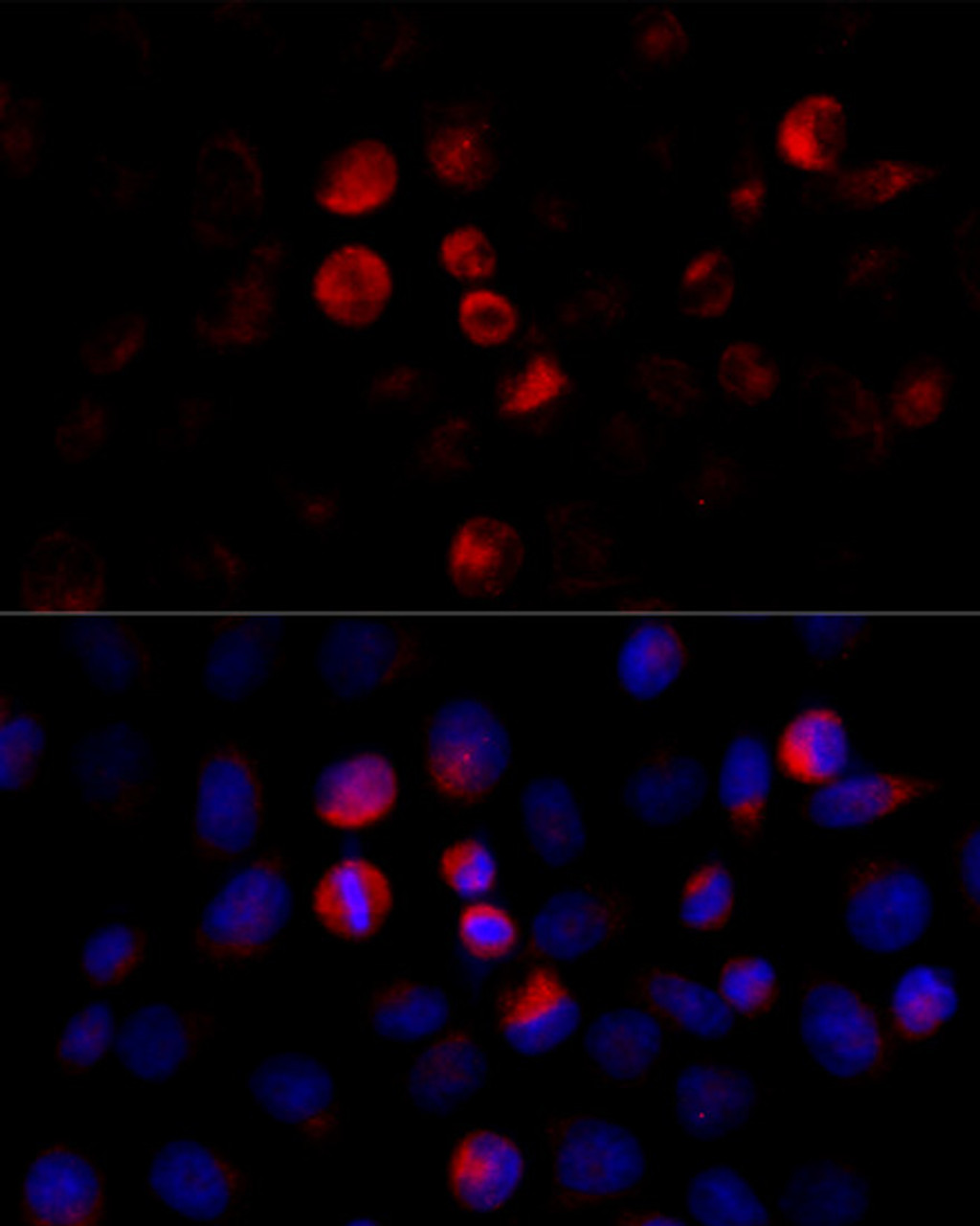 Immunofluorescence analysis of HeLa cells using BCAP29 Polyclonal Antibody at dilution of  1:100 (40x lens). Blue: DAPI for nuclear staining.