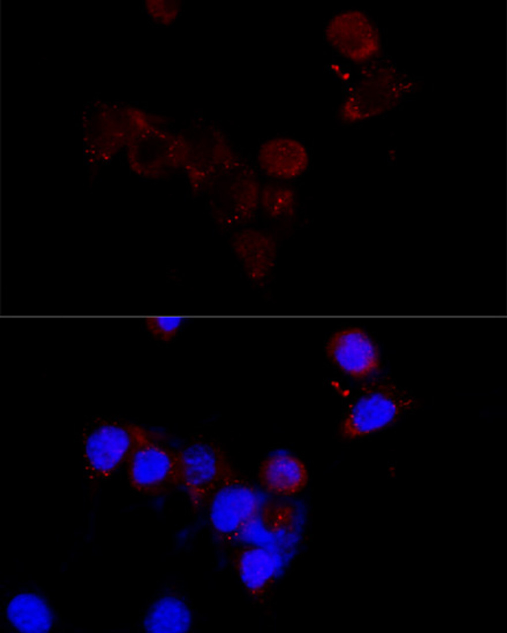 Immunofluorescence analysis of NIH/3T3 cells using BCAP29 Polyclonal Antibody at dilution of  1:100 (40x lens). Blue: DAPI for nuclear staining.