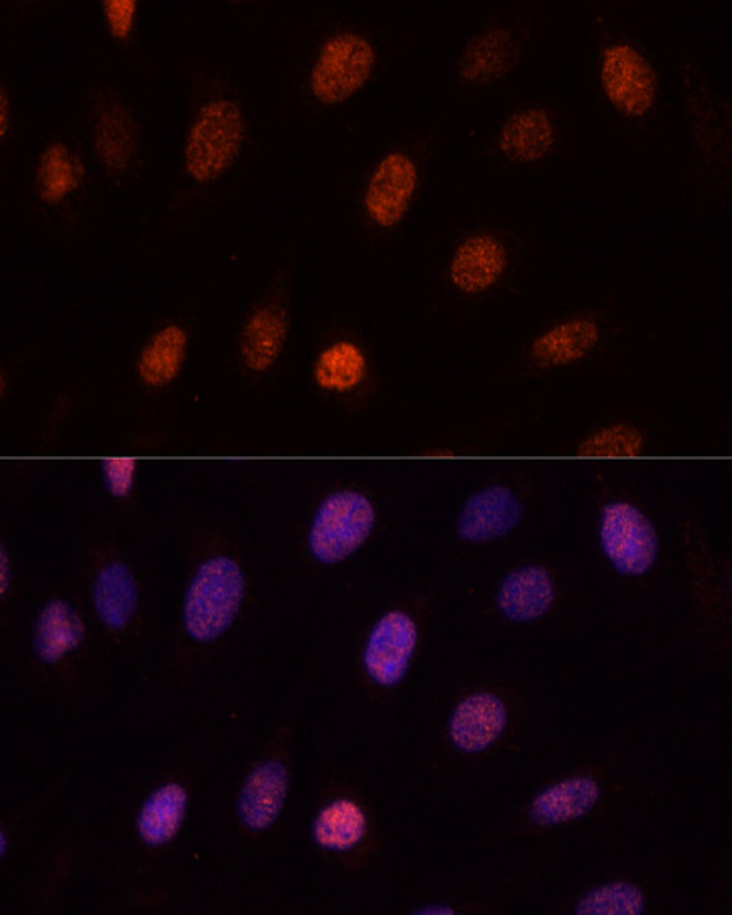 Immunofluorescence analysis of U-2OS cells using PCGF1 Polyclonal Antibody at dilution of  1:100. Blue: DAPI for nuclear staining.