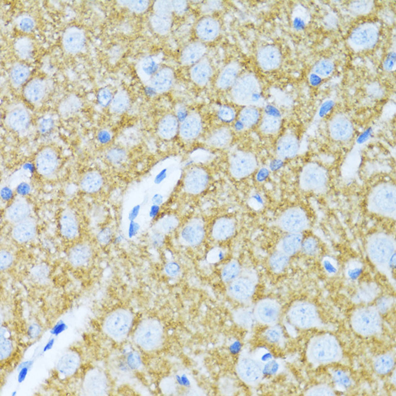 Immunohistochemistry of paraffin-embedded Rat brain using SYP Polyclonal Antibody at dilution of  1:100 (40x lens).