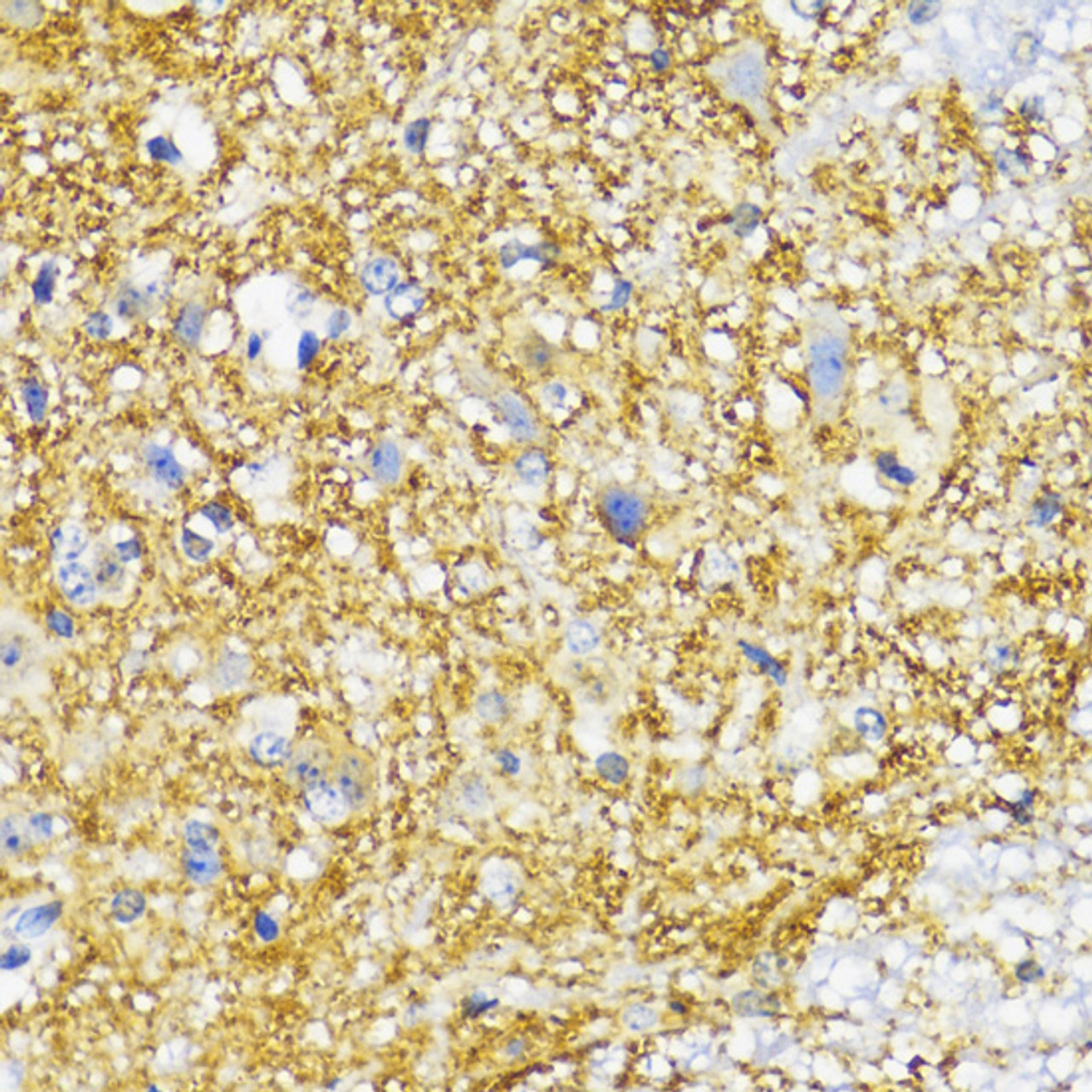 Immunohistochemistry of paraffin-embedded Mouse spinal cord using SYP Polyclonal Antibody at dilution of  1:100 (40x lens).