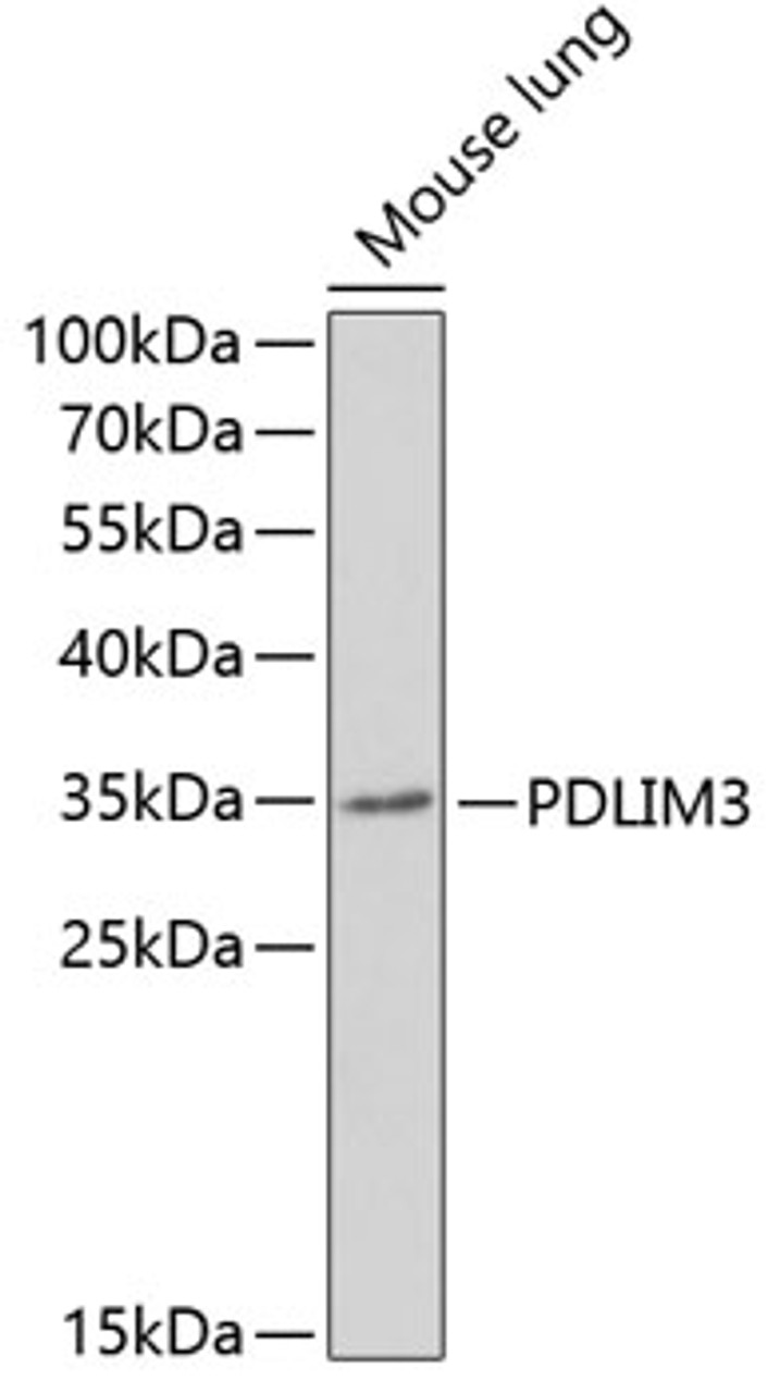 Western blot analysis of extracts of Mouse lung using PDLIM3 Polyclonal Antibody at dilution of 1:1000.