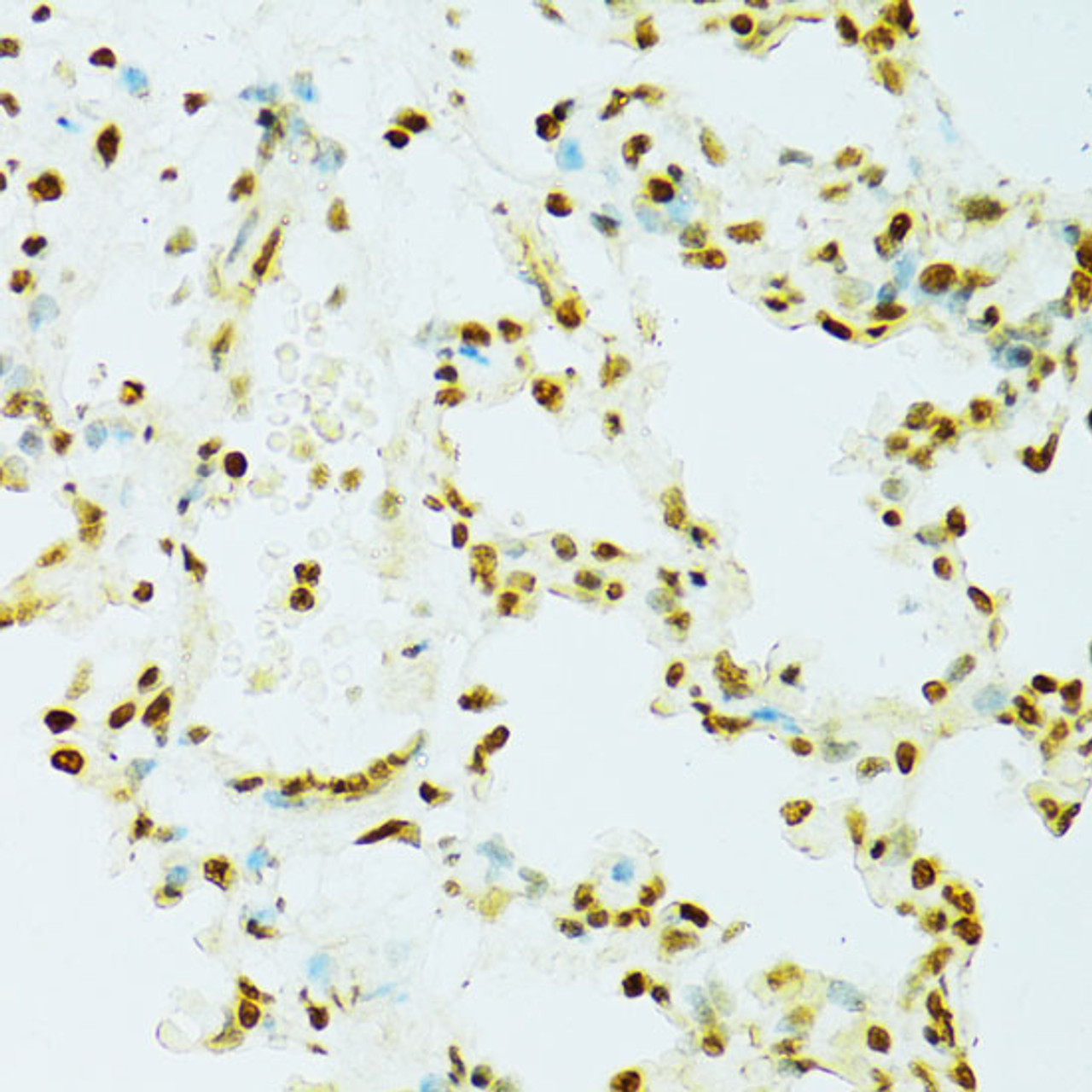 Immunohistochemistry of paraffin-embedded Rat lung using RCC1 Polyclonal Antibody at dilution of  1:100 (40x lens).