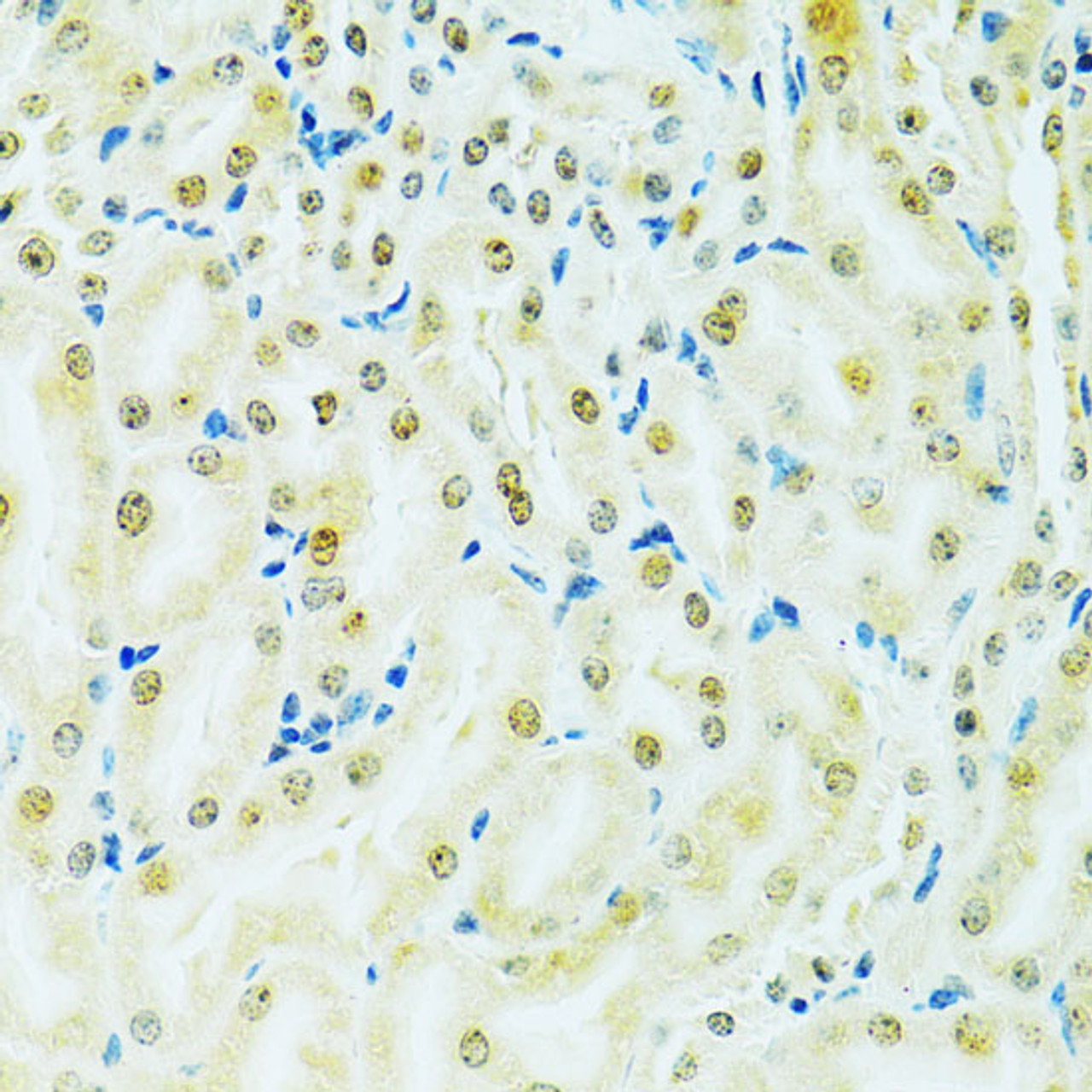 Immunohistochemistry of paraffin-embedded Mouse kidney using RCC1 Polyclonal Antibody at dilution of  1:100 (40x lens).