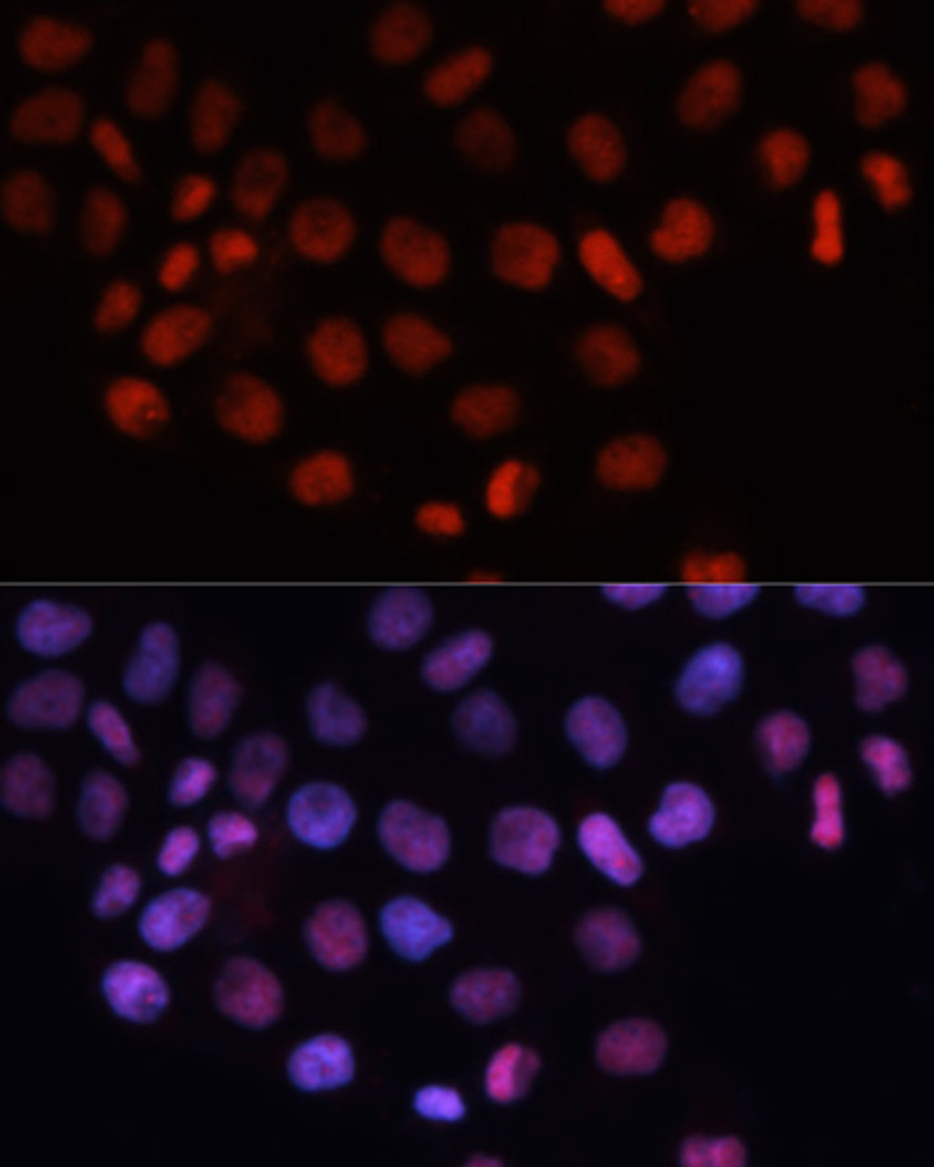 Immunofluorescence analysis of HeLa cells using RCC1 Polyclonal Antibody at dilution of  1:100. Blue: DAPI for nuclear staining.