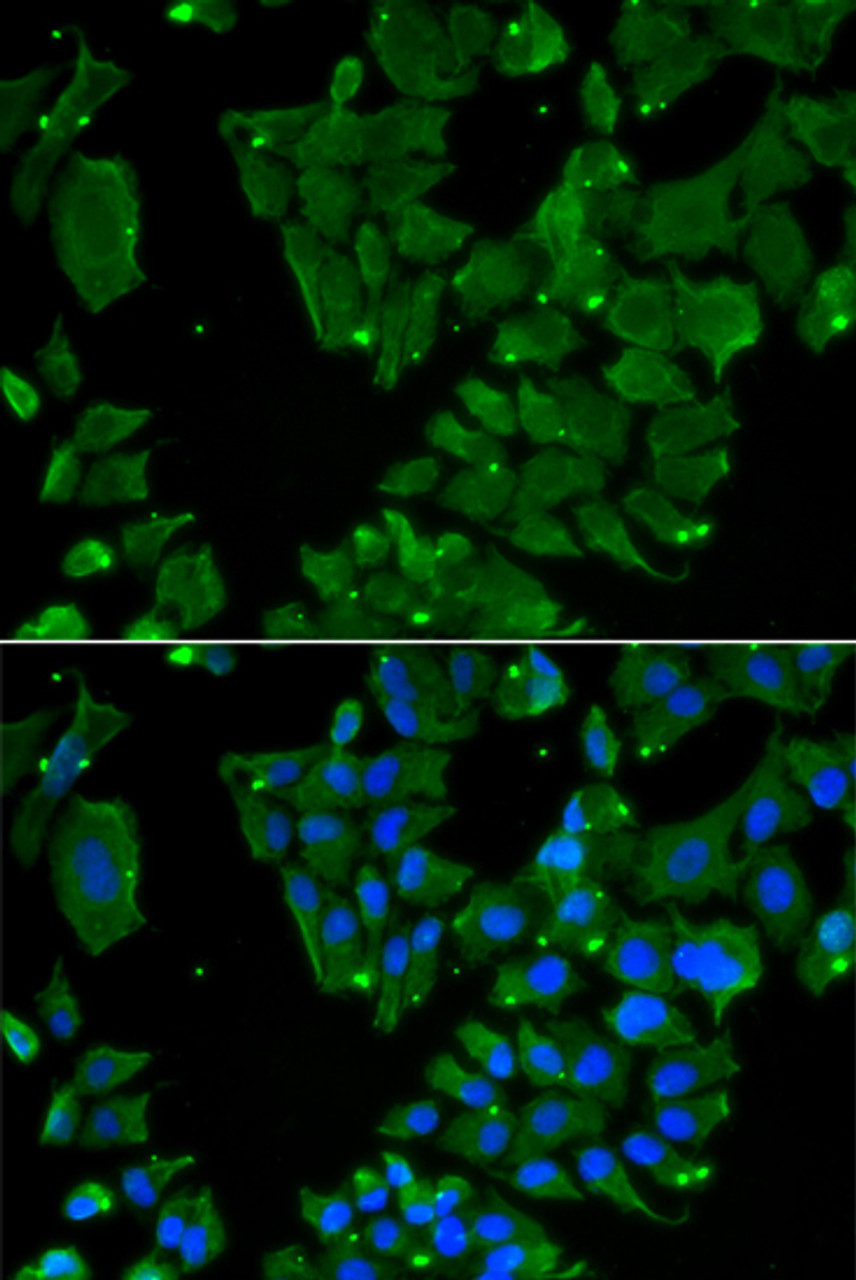 Immunofluorescence analysis of HeLa cells using DBN1 Polyclonal Antibody
