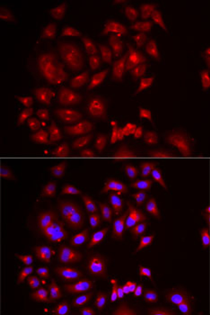 Immunofluorescence analysis of MCF7 cells using SLC26A2 Polyclonal Antibody
