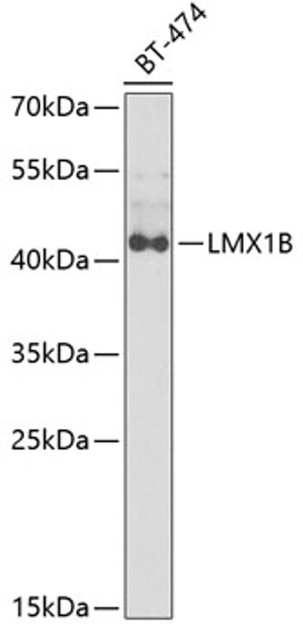 Western blot analysis of extracts of BT-474 cells using LMX1B Polyclonal Antibody at dilution of 1:1000.