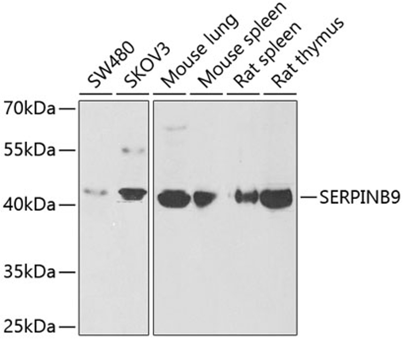 Western blot analysis of extracts of various cell lines using SERPINB9 Polyclonal Antibody at dilution of 1:1000.