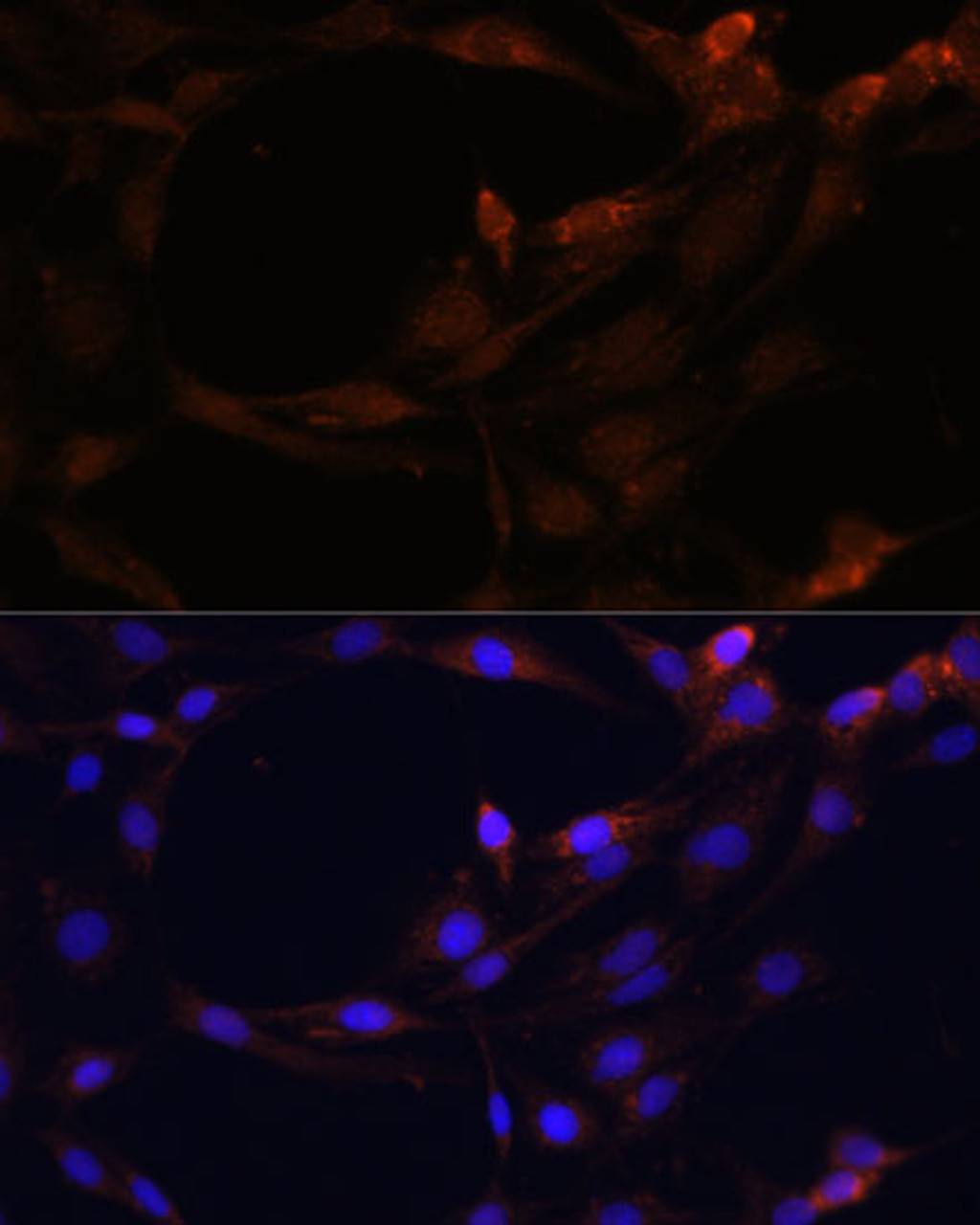 Immunofluorescence analysis of C6 cells using SERPINB9 Polyclonal Antibody at dilution of  1:100. Blue: DAPI for nuclear staining.