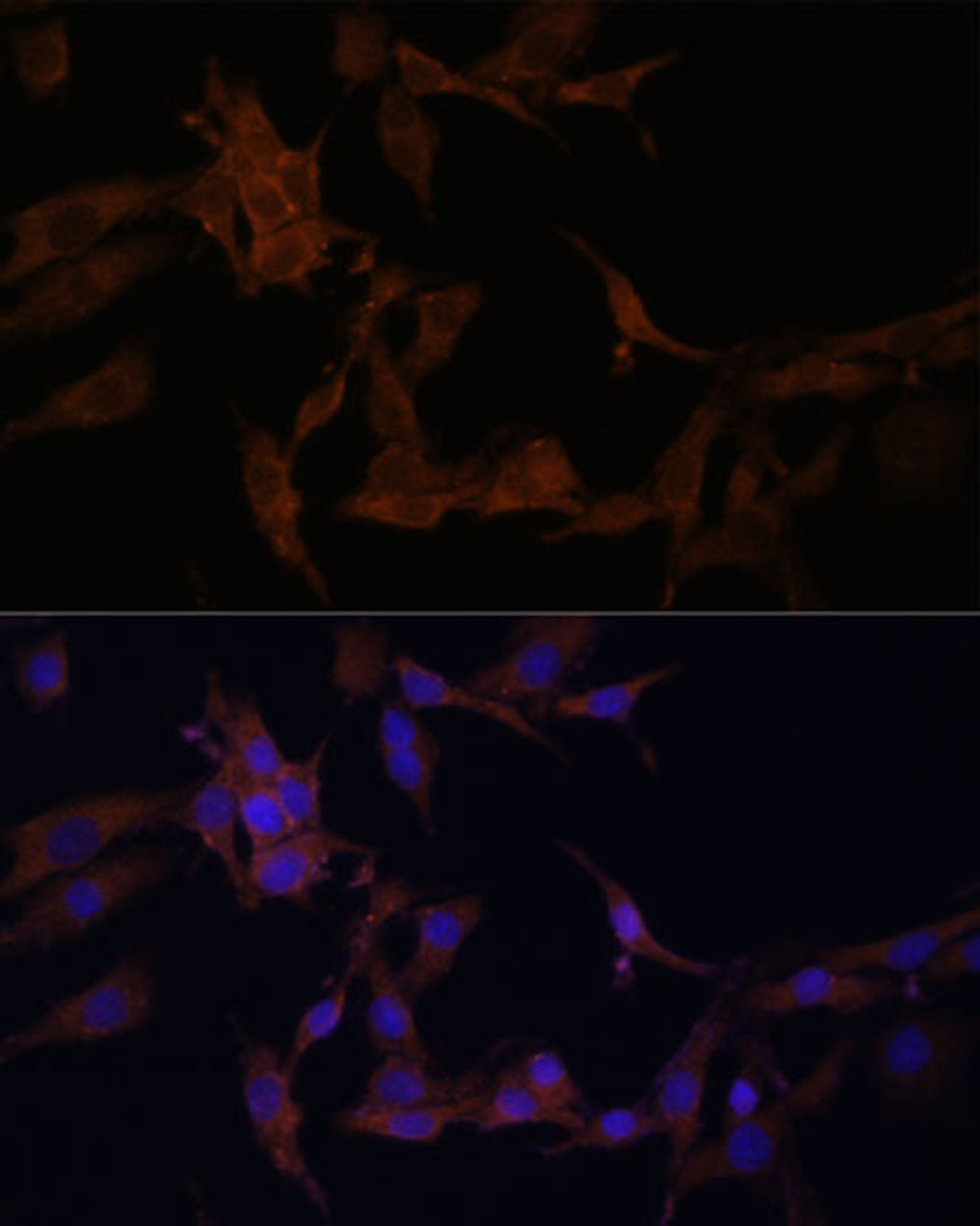 Immunofluorescence analysis of HeLa cells using SERPINB9 Polyclonal Antibody at dilution of  1:100. Blue: DAPI for nuclear staining.