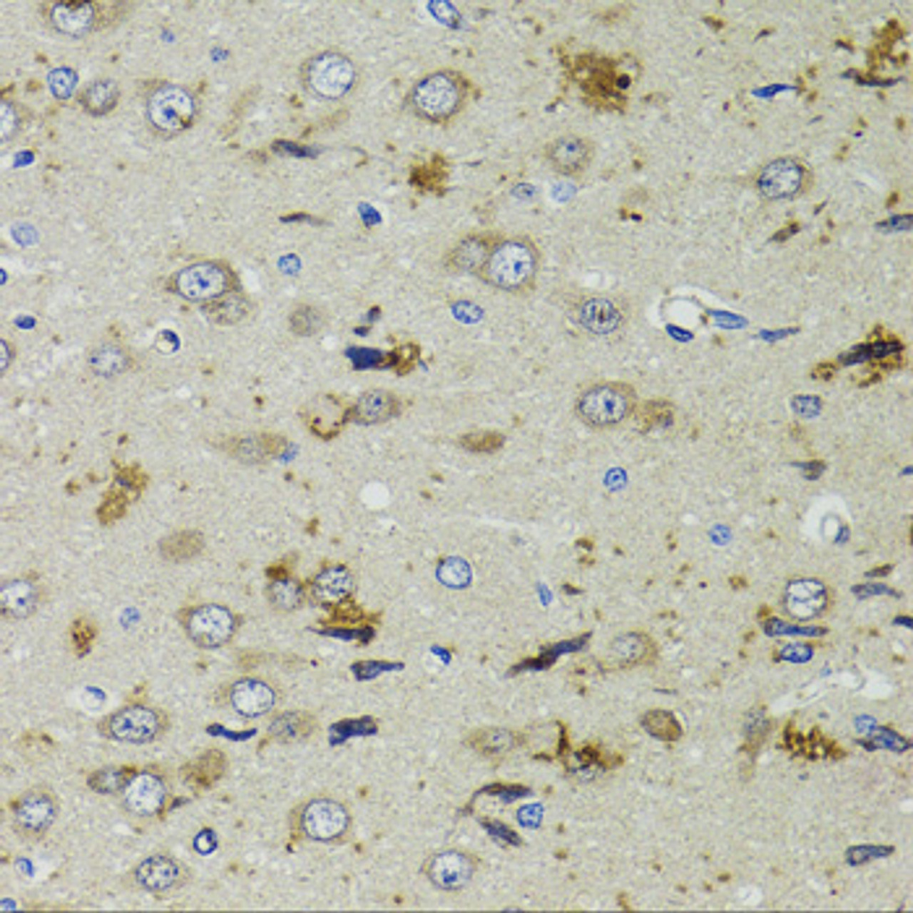 Immunohistochemistry of paraffin-embedded Rat brain using PTPN3 Polyclonal Antibody at dilution of  1:100 (40x lens).