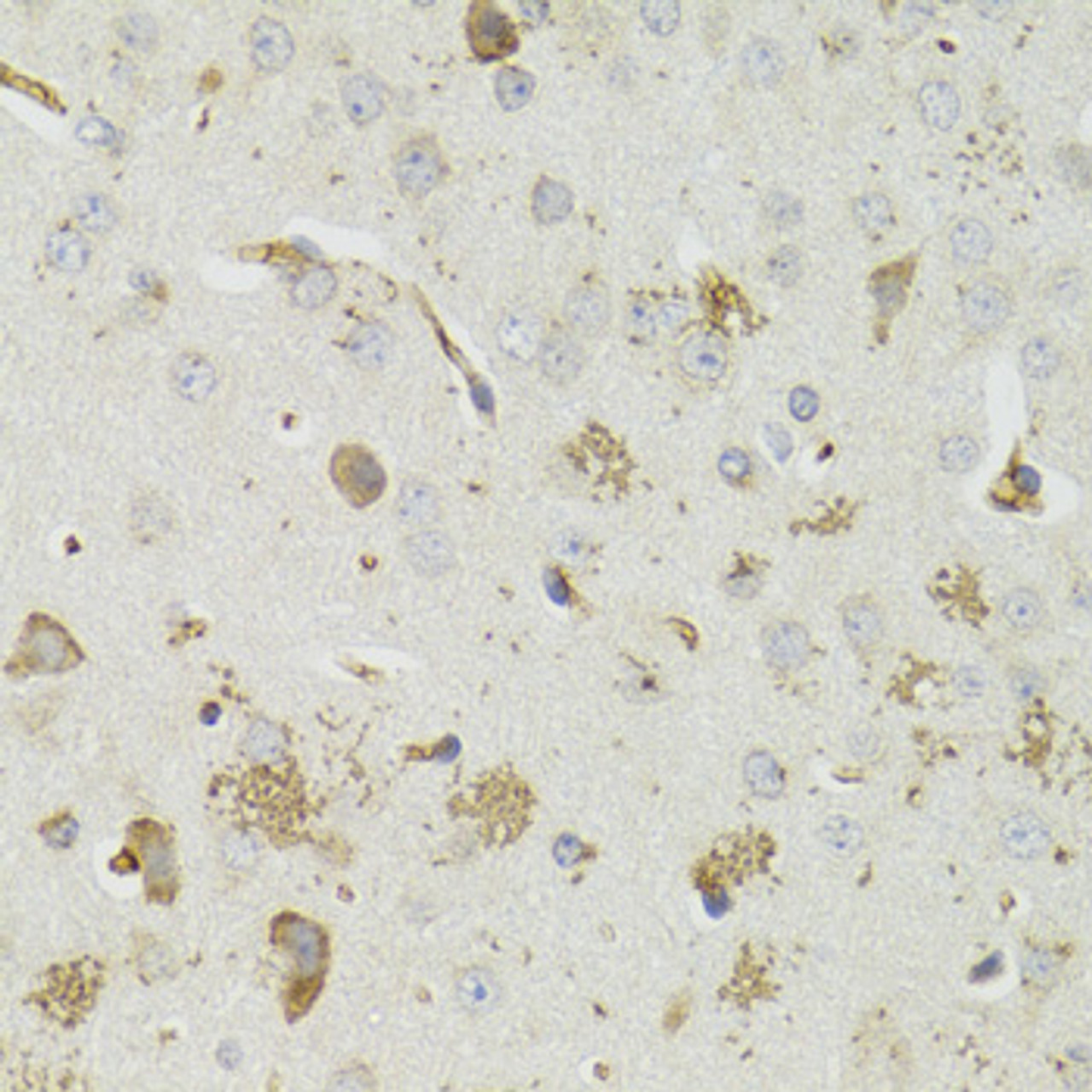 Immunohistochemistry of paraffin-embedded Mouse brain using PTPN3 Polyclonal Antibody at dilution of  1:100 (40x lens).