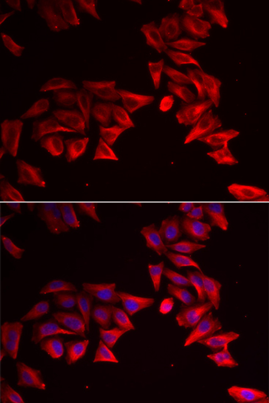 Immunofluorescence analysis of HeLa cells using SFRP4 Polyclonal Antibody