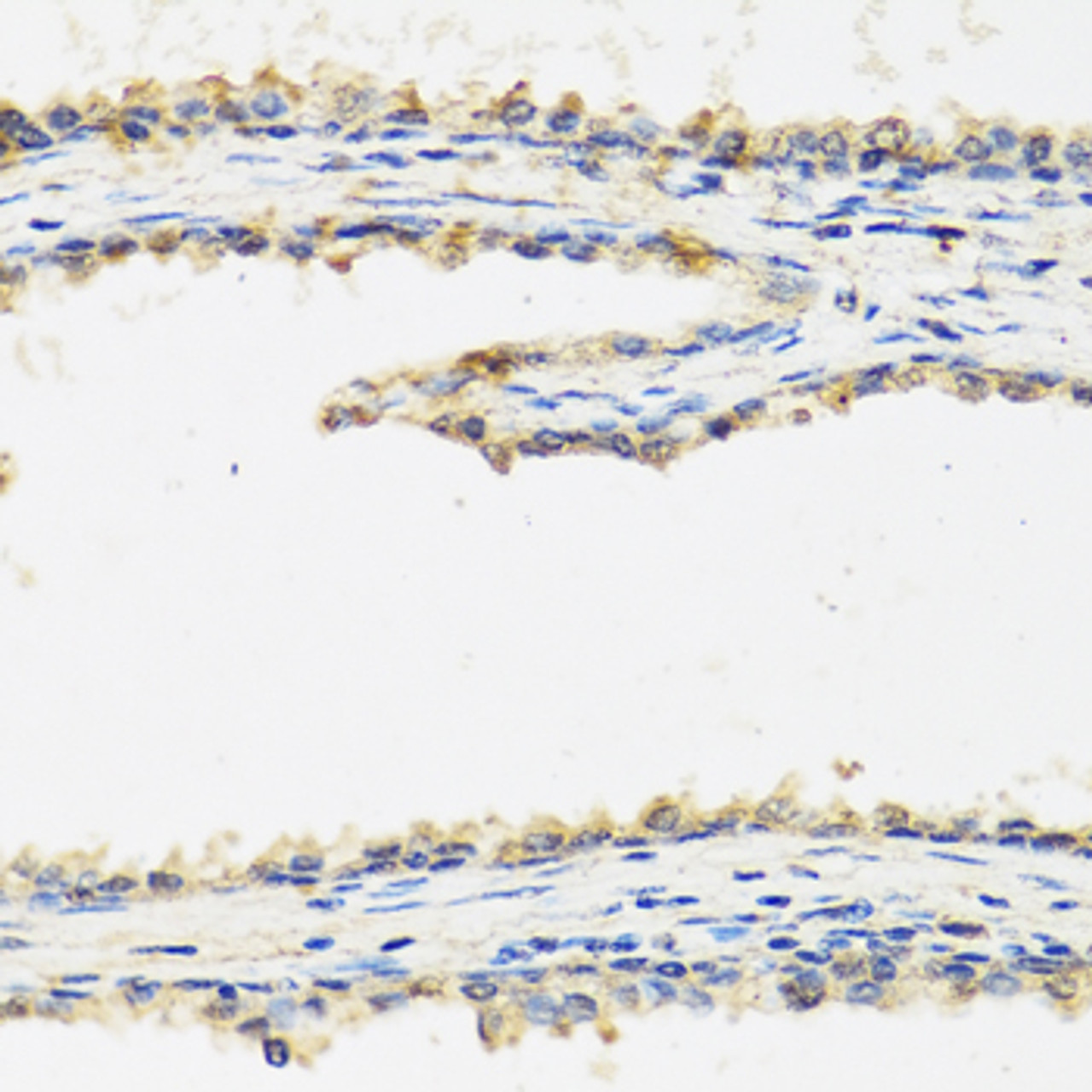 Immunohistochemistry of paraffin-embedded Human prostate using SPINT1 Polyclonal Antibody at dilution of  1:100 (40x lens).
