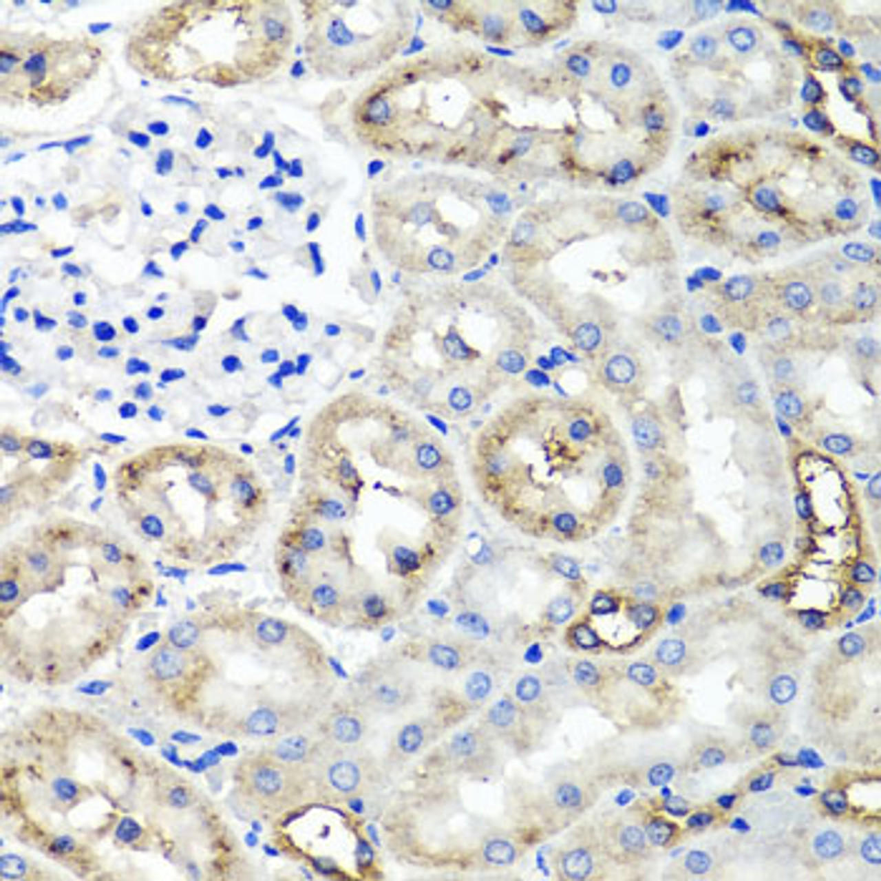 Immunohistochemistry of paraffin-embedded Rat kidney using TNFAIP6 Polyclonal Antibody at dilution of  1:100 (40x lens).