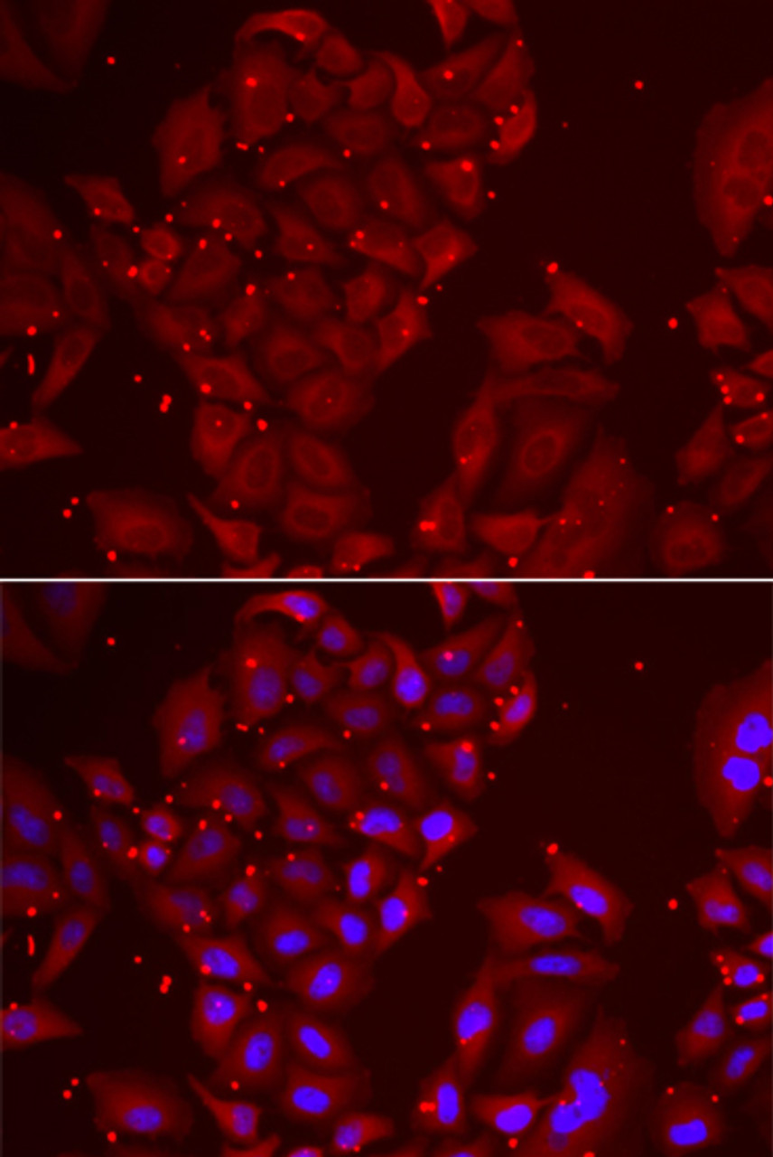 Immunofluorescence analysis of U2OS cells using TPP2 Polyclonal Antibody