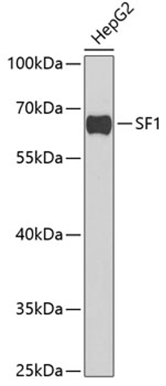 Western blot analysis of extracts of HepG2 cells using SF1 Polyclonal Antibody at dilution of 1:1000.