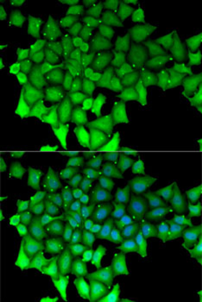 Immunofluorescence analysis of MCF7 cells using RNGTT Polyclonal Antibody