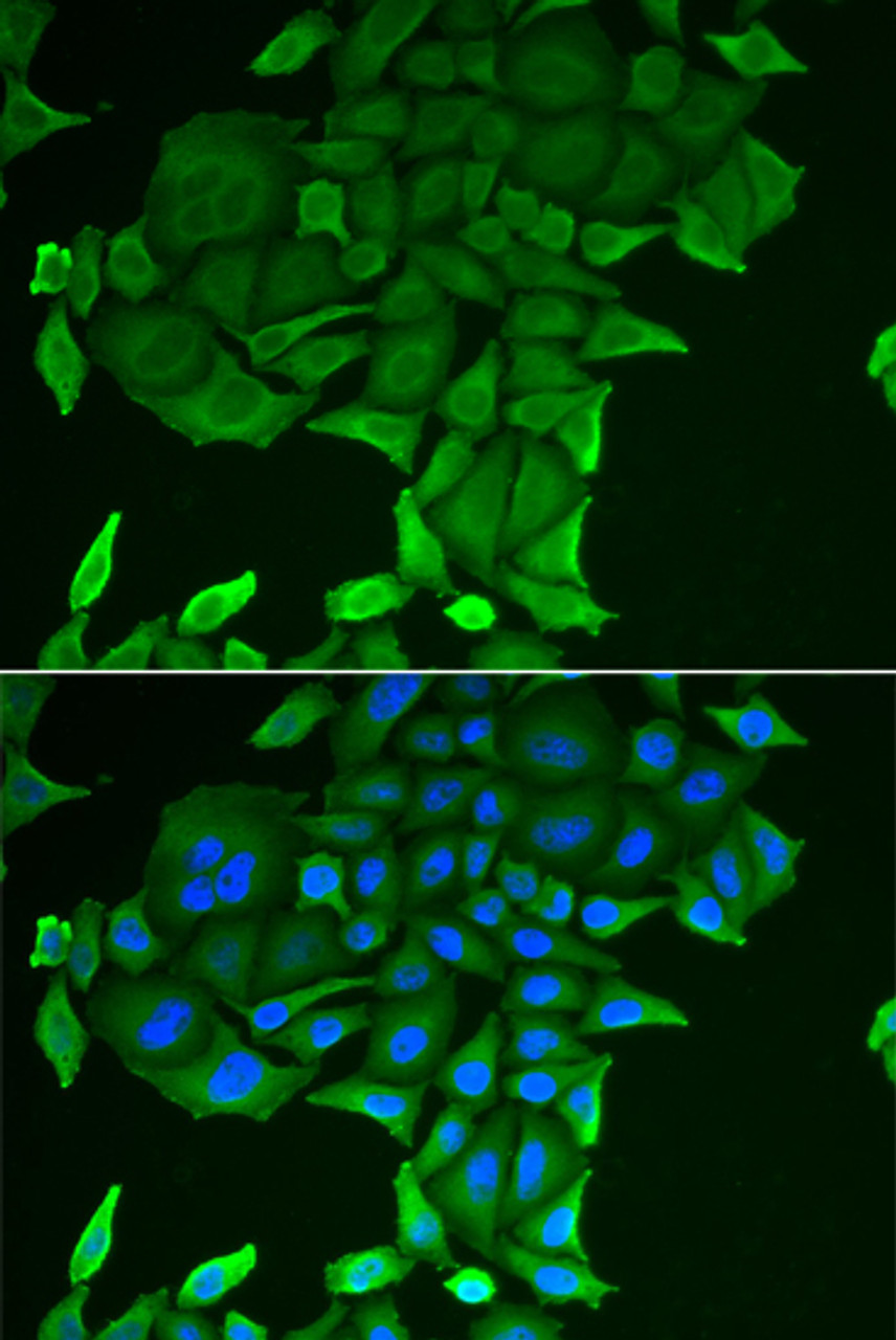 Immunofluorescence analysis of HeLa cells using CD84 Polyclonal Antibody