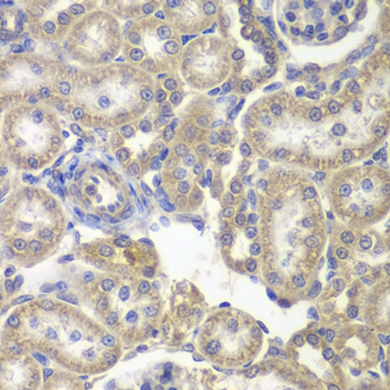 Immunohistochemistry of paraffin-embedded Rat kidney using H6PD Polyclonal Antibody at dilution of  1:200 (40x lens).