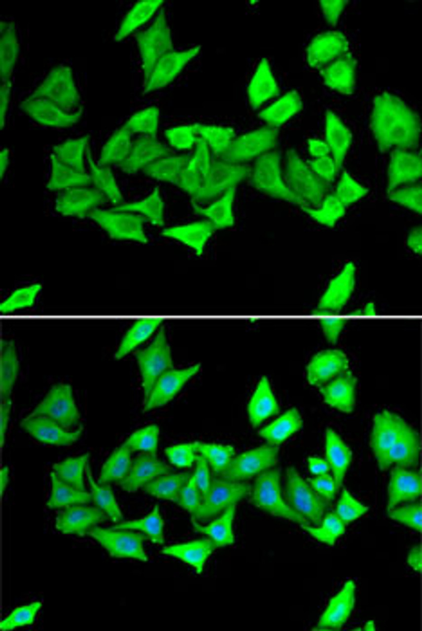 Immunofluorescence analysis of U2OS cells using H6PD Polyclonal Antibody