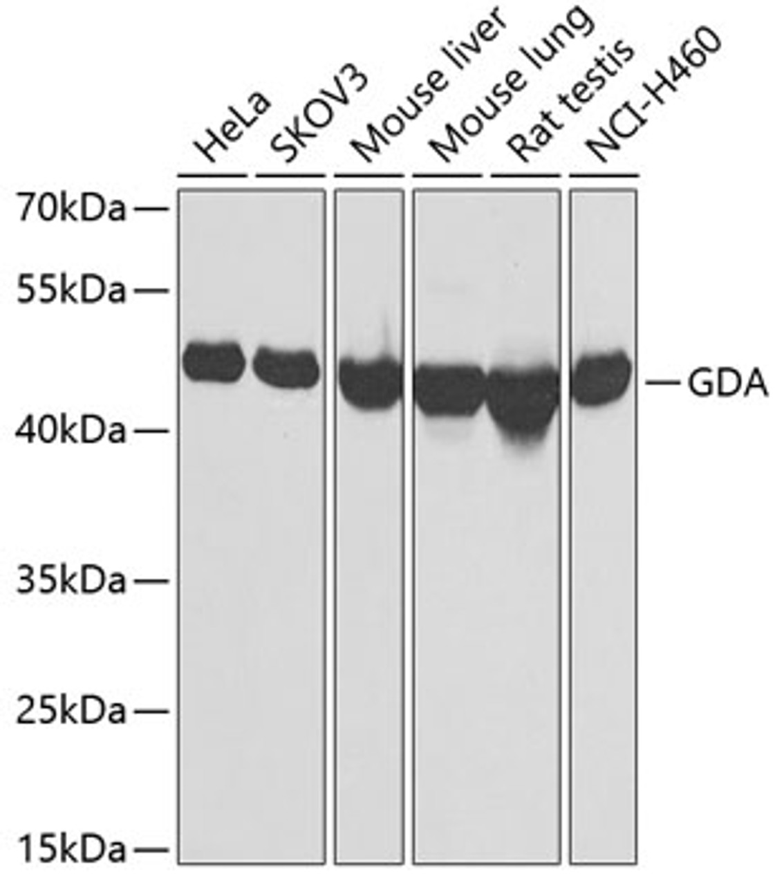 Western blot analysis of extracts of various cell lines using GDA Polyclonal Antibody at dilution of 1:1000.