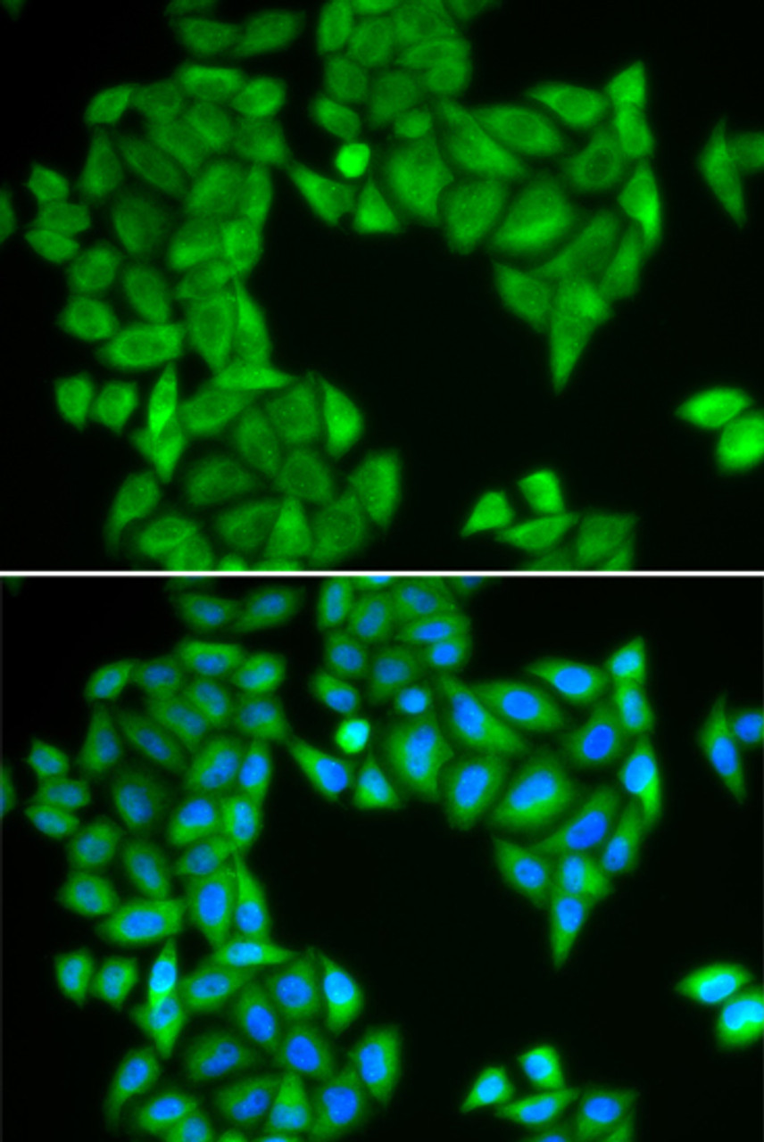Immunofluorescence analysis of HeLa cells using SPAG5 Polyclonal Antibody
