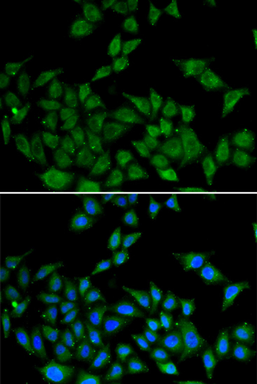 Immunofluorescence analysis of HeLa cells using DIDO1 Polyclonal Antibody