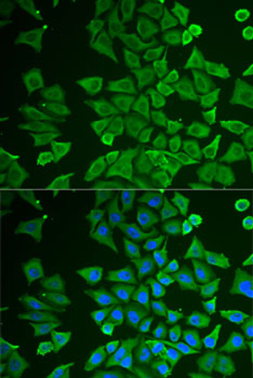 Immunofluorescence analysis of U2OS cells using DDAH2 Polyclonal Antibody