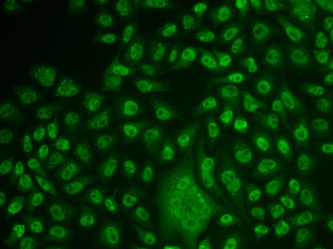 Immunofluorescence analysis of U2OS cells using TFPT Polyclonal Antibody