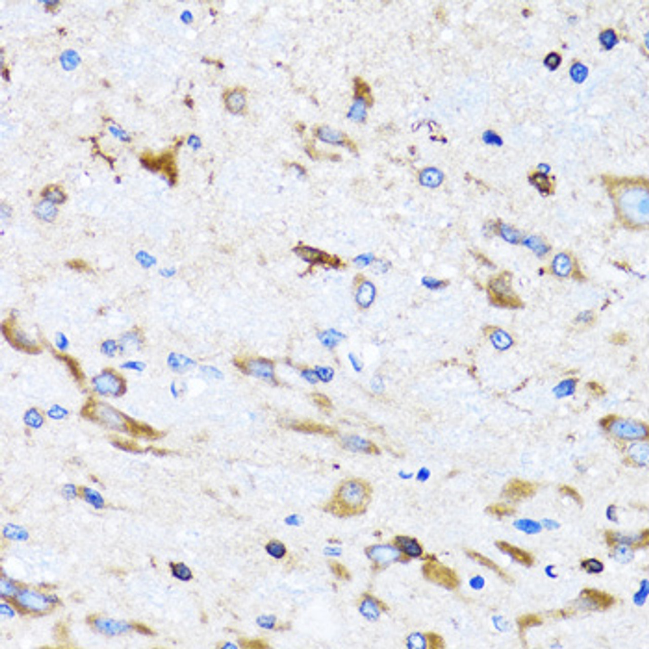 Immunohistochemistry of paraffin-embedded Mouse spinal cord using PTRH2 Polyclonal Antibody at dilution of  1:100 (40x lens).