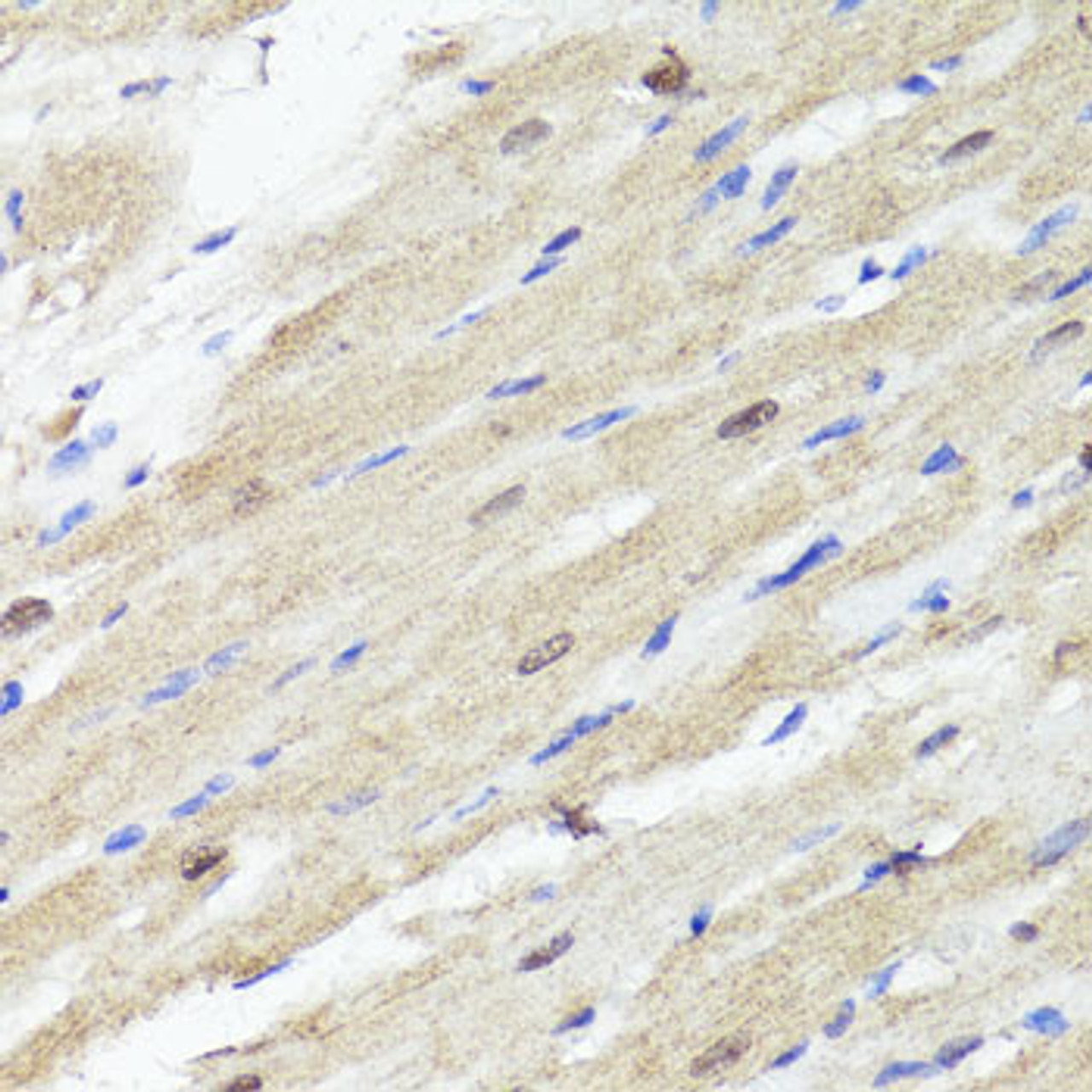 Immunohistochemistry of paraffin-embedded Rat heart using ACSS2 Polyclonal Antibody at dilution of  1:100 (40x lens).