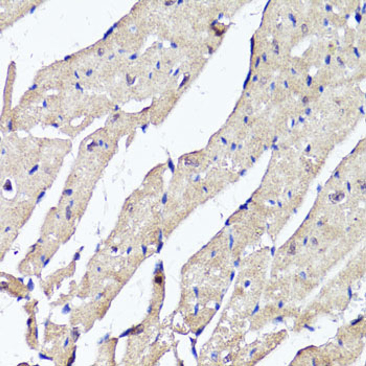 Immunohistochemistry of paraffin-embedded Mouse heart using ACSS2 Polyclonal Antibody at dilution of  1:100 (40x lens).