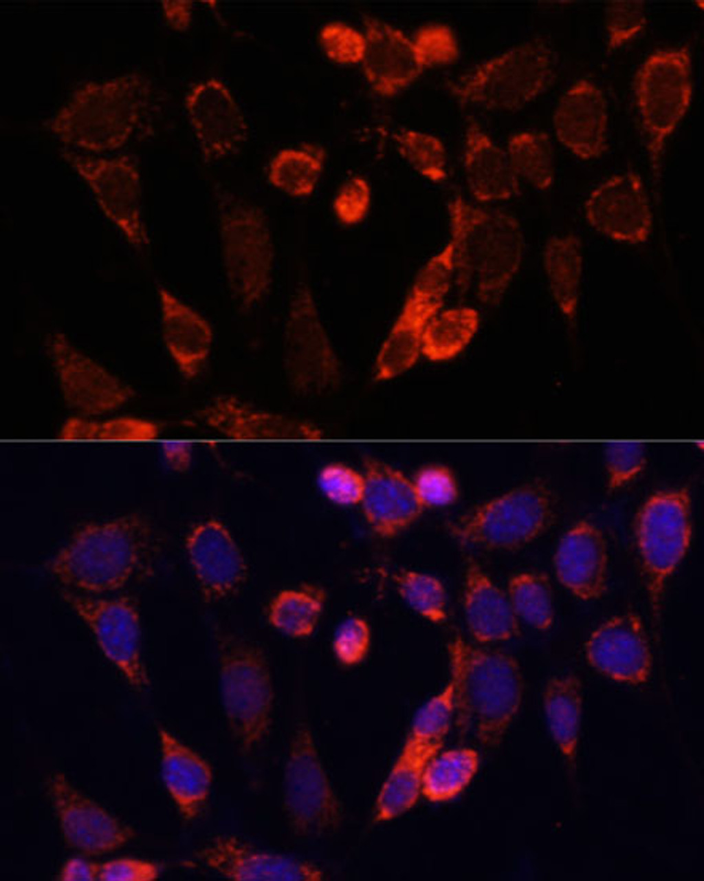 Immunofluorescence analysis of NIH/3T3 cells using ACSS2 Polyclonal Antibody at dilution of  1:100. Blue: DAPI for nuclear staining.