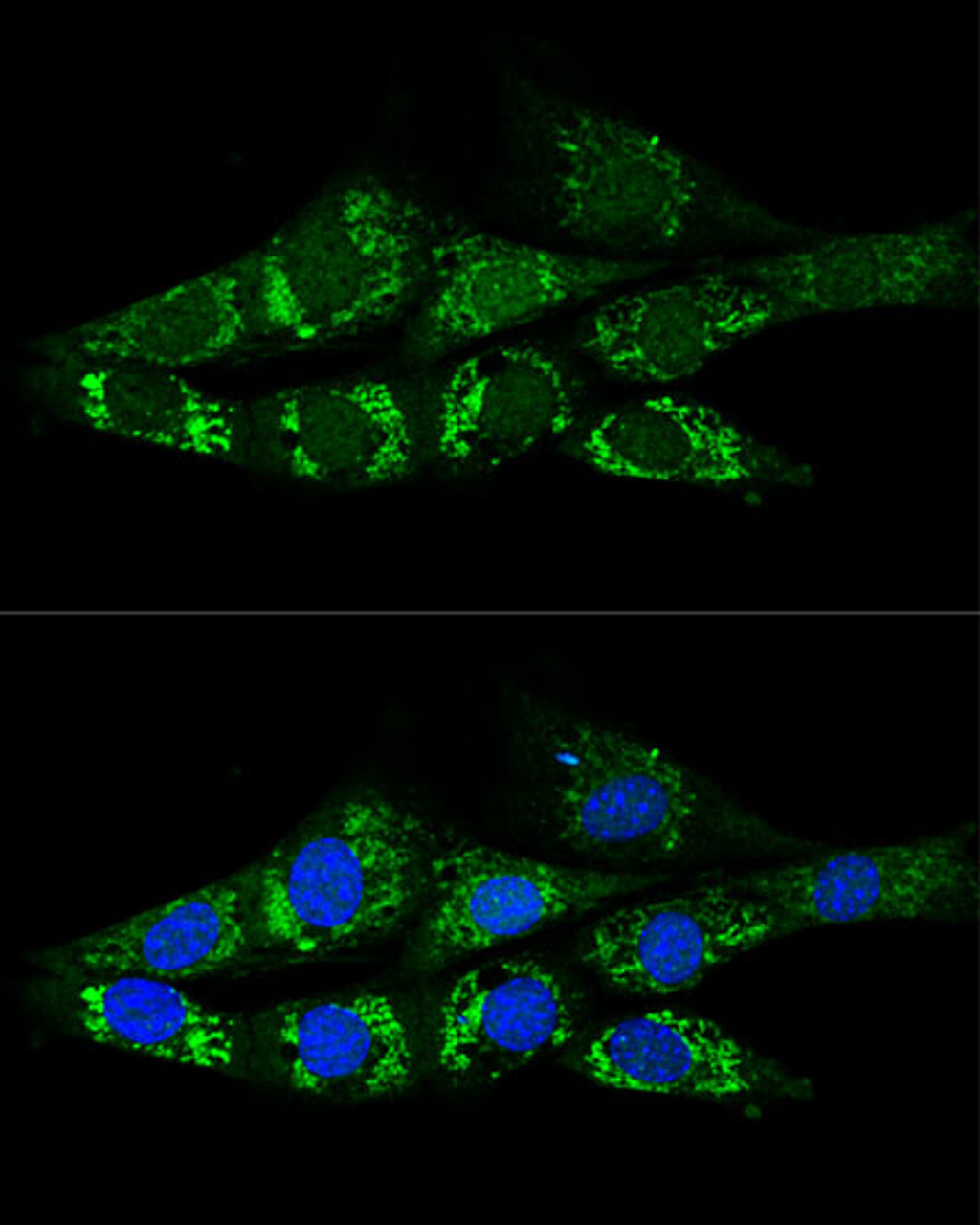Confocal immunofluorescence analysis of NIH-3T3 cells using ACSS2 Polyclonal Antibody at dilution of  1:200. Blue: DAPI for nuclear staining.