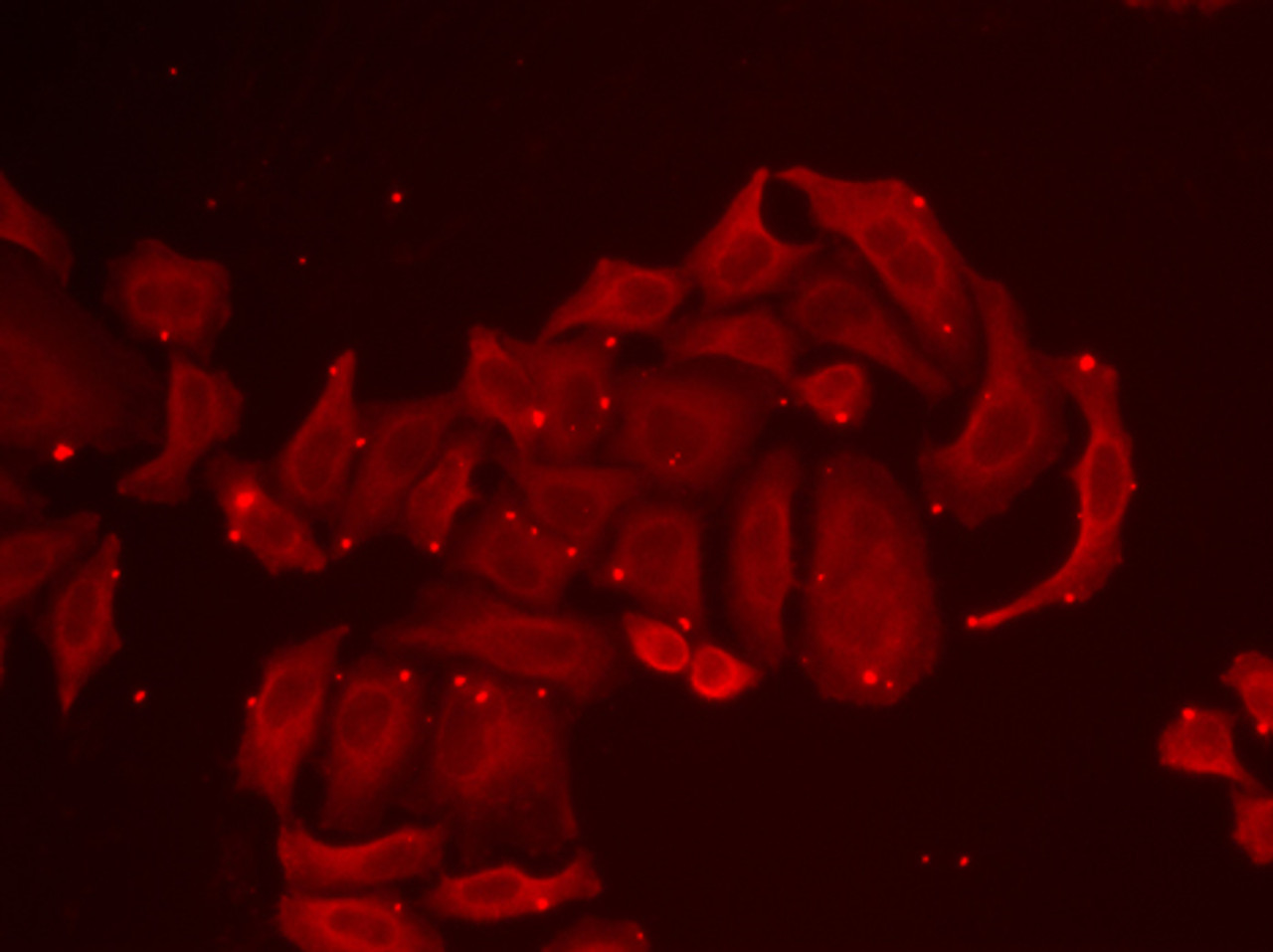Immunofluorescence analysis of U2OS cells using TRPV5 Polyclonal Antibody