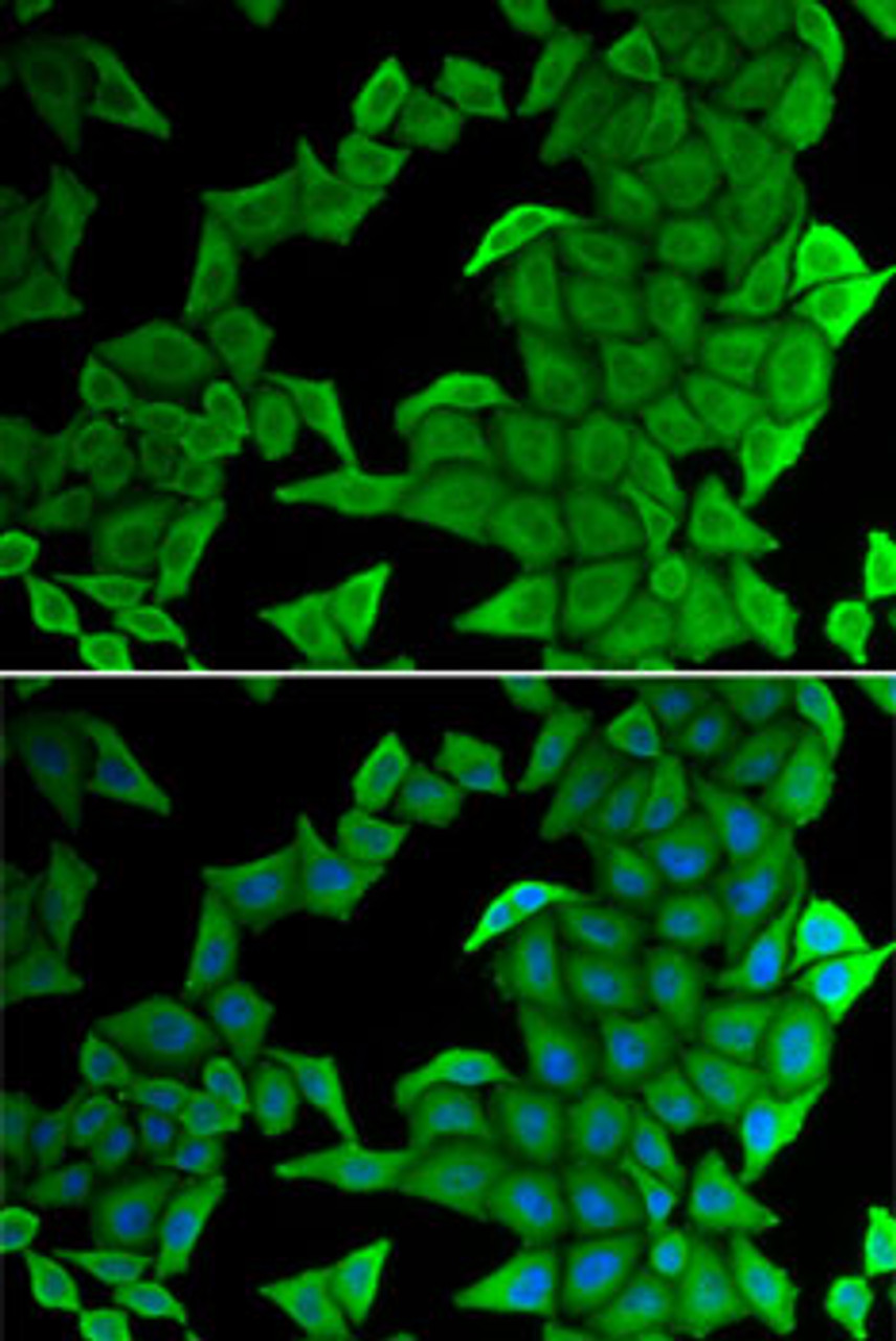 Immunofluorescence analysis of U2OS cells using SMYD2 Polyclonal Antibody