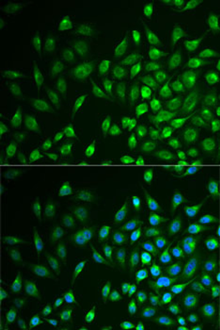 Immunofluorescence analysis of U2OS cells using LNX1 Polyclonal Antibody