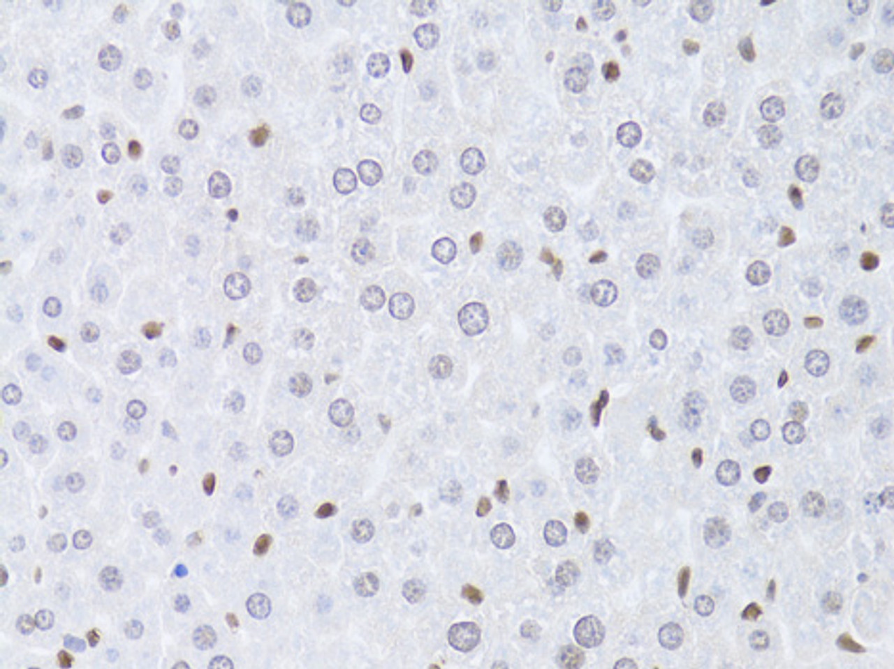 Immunohistochemistry of paraffin-embedded Mouse liver using LMNB2 Polyclonal Antibody at dilution of  1:100 (40x lens).