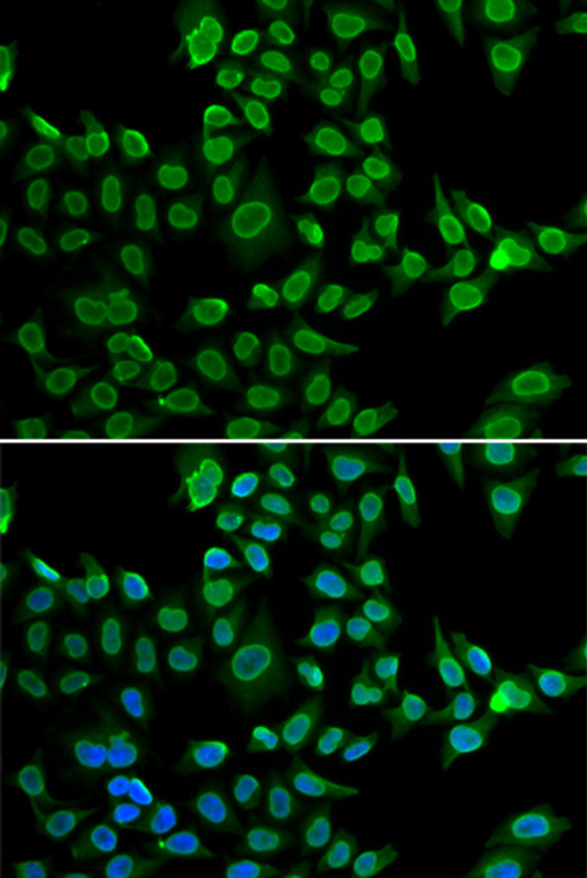 Immunofluorescence analysis of U2OS cells using LMNB2 Polyclonal Antibody